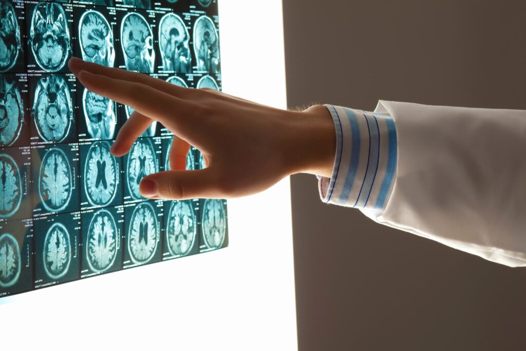 Traumatic brain injury lawyer Memphis, TN